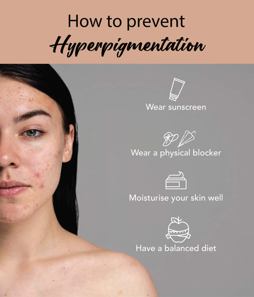 This is an image of How to prevent Hyperpigmentation on www.sublimelife.in 