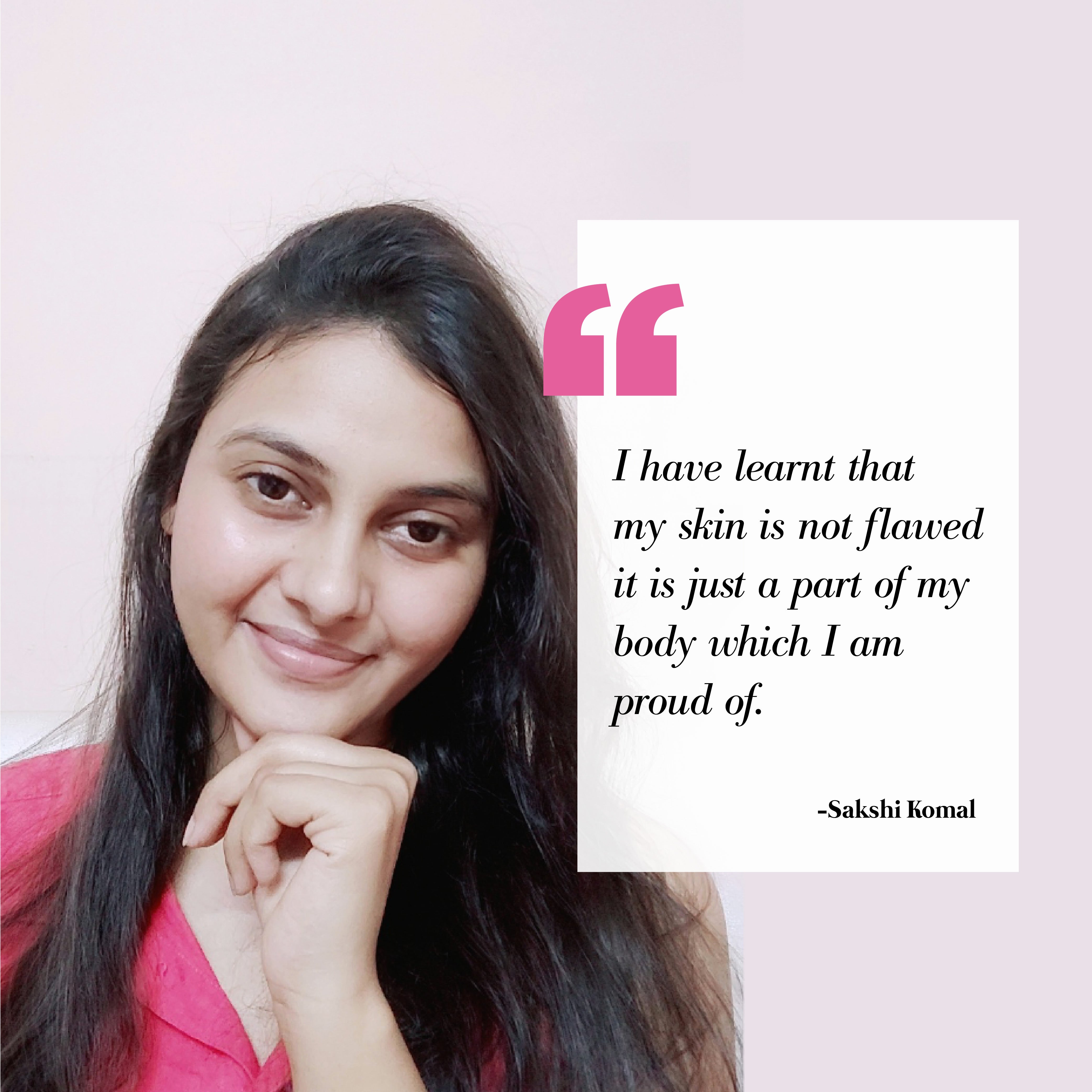 This is an image of Sakshi for a blog on acne and mental health on www.sublimelife.in 