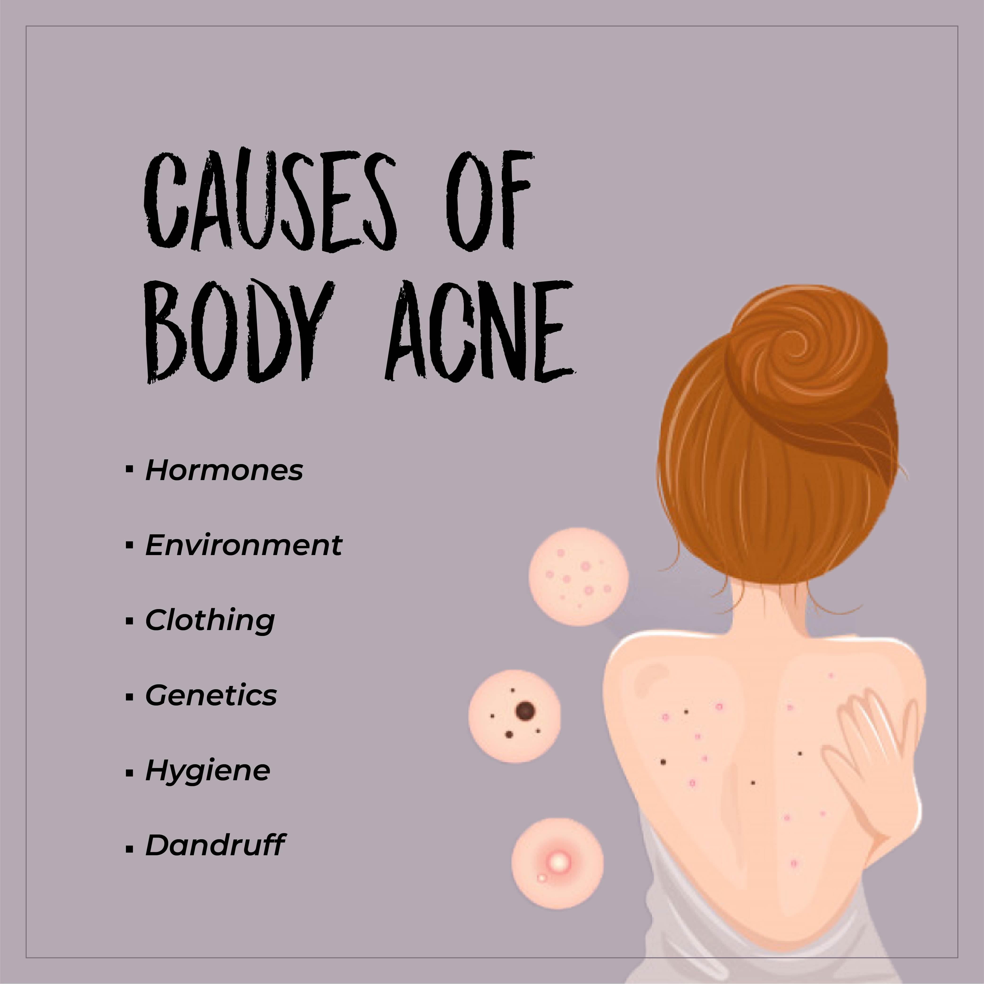 This is an image of the causes of body acne