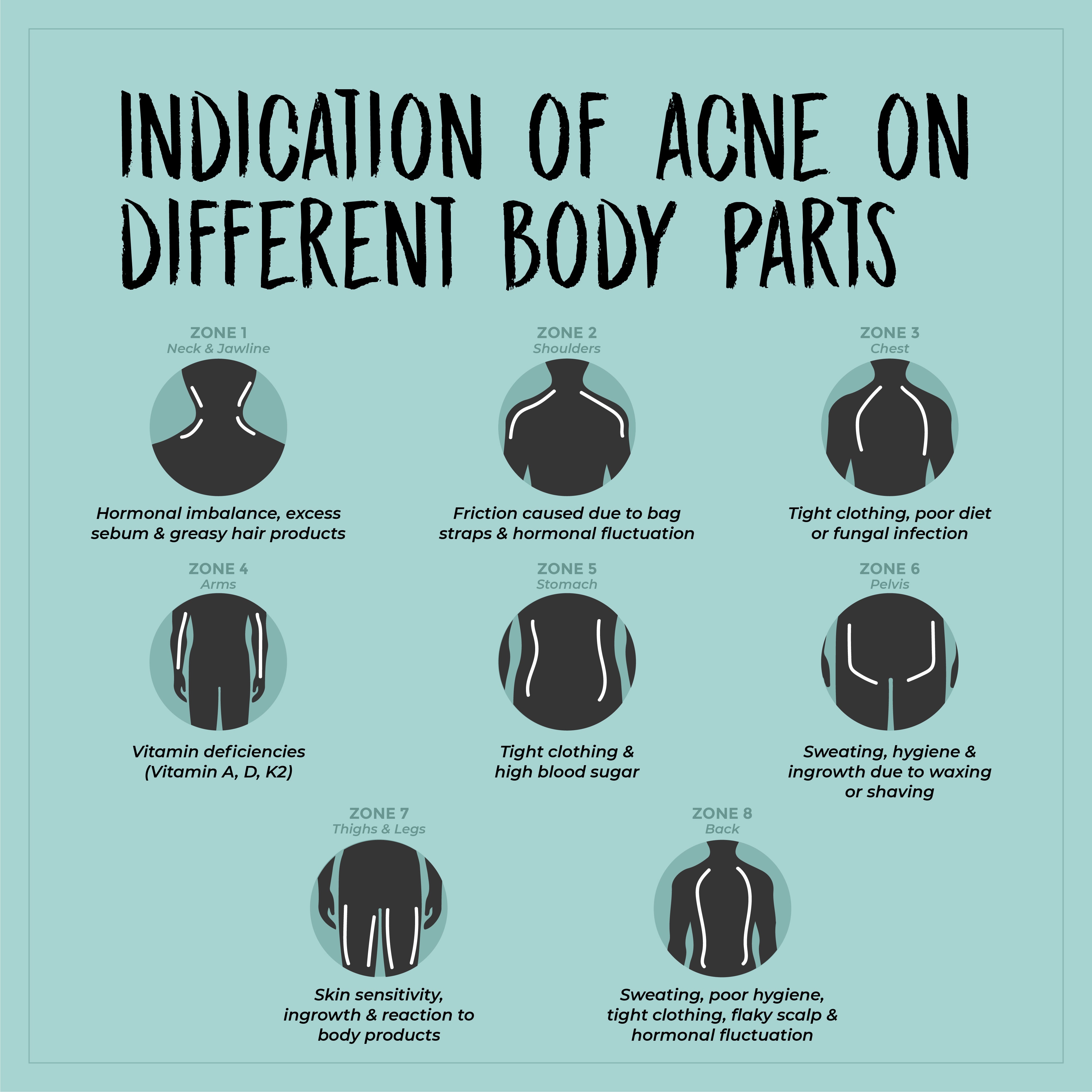 This is an image of indication of acne on different body parts