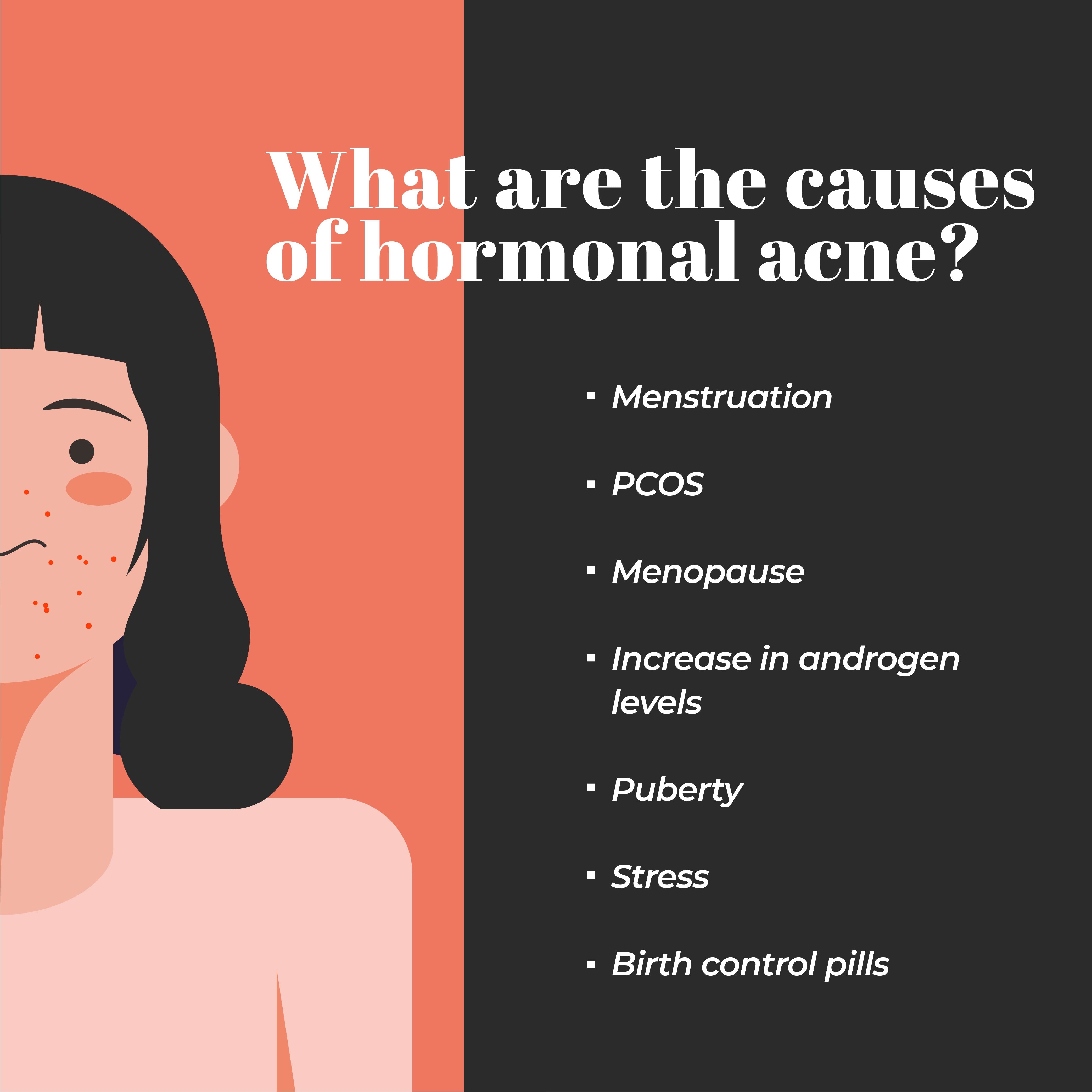 This is an image of the reasons of hormonal acne
