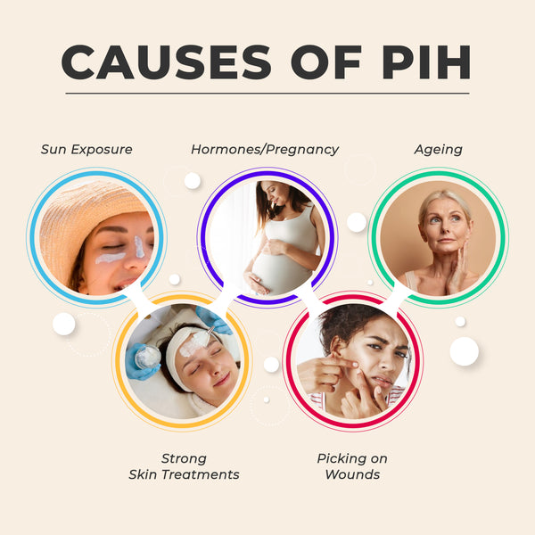 This is an image of Causes of PIH on www.sublimelife.in 