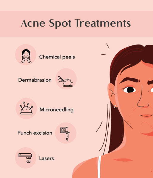 This is an image of types of acne spot treatments on www.sublimelife.in 