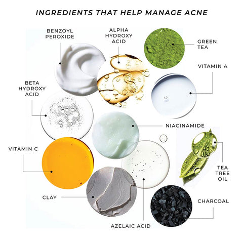 This is an image showing different ingredients that can be used for treating acne prone skin