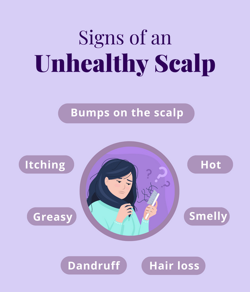 This is an image on Signs of an Unhealthy Scalp on www.sublimelife.in