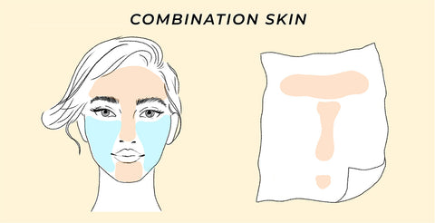 This is the skin test result for combination skin