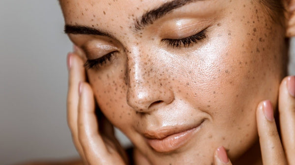 Close up of woman’s face with hydrated skin after microneedling treatment