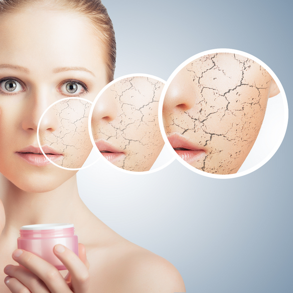 Skincare for cracked skin