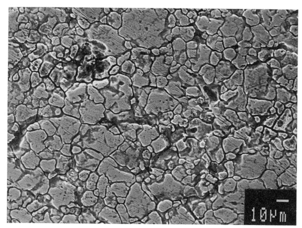 Intergranular corrosion grain boundary attack and dropped grains.