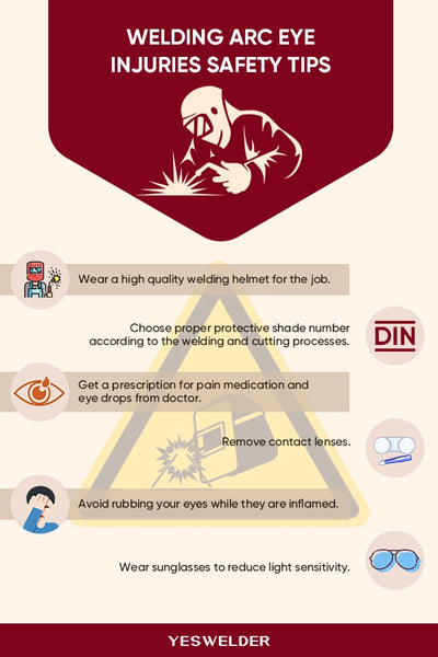 welding arc eye injuries safety tips