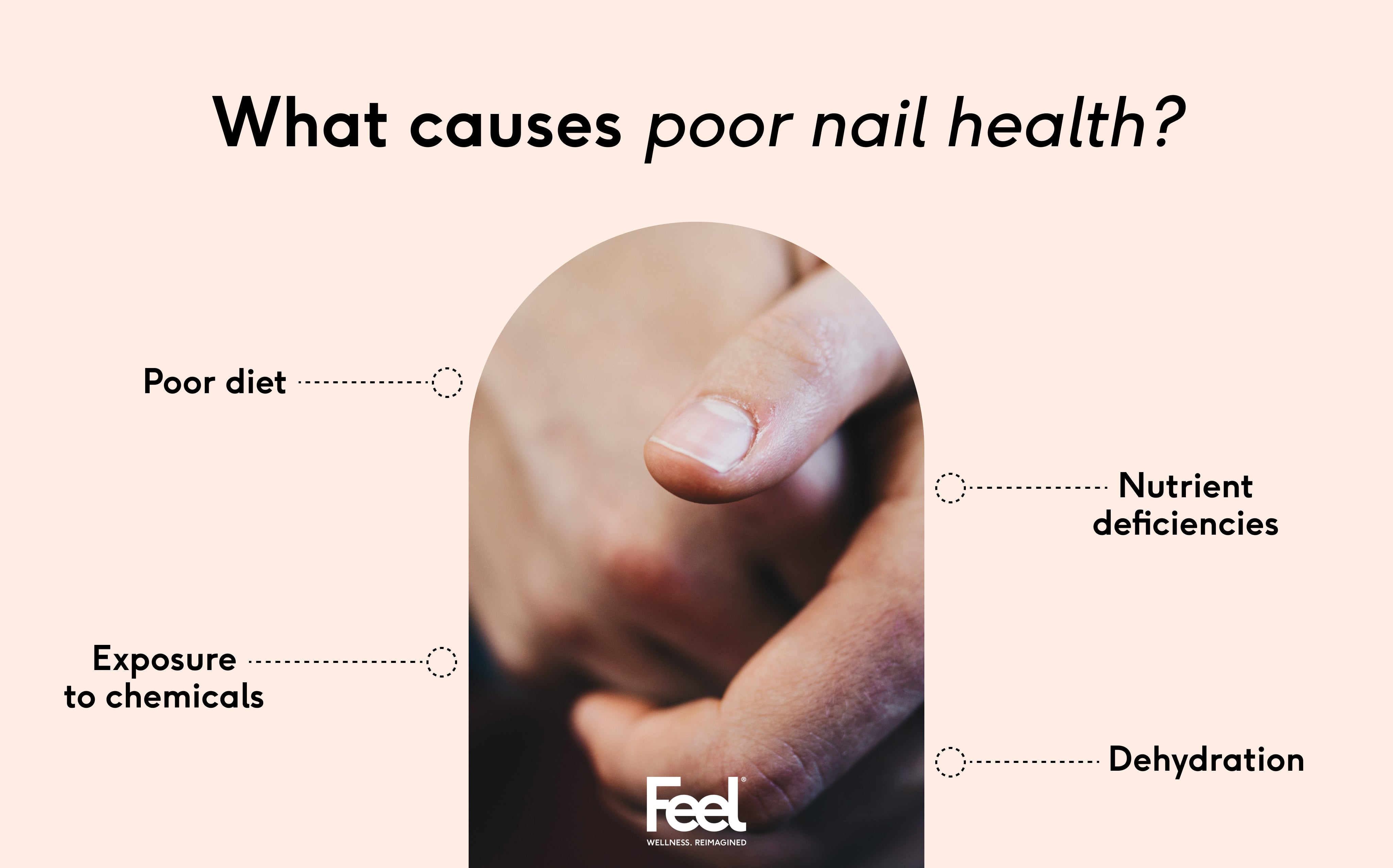 5 foods for healthy and strong nails