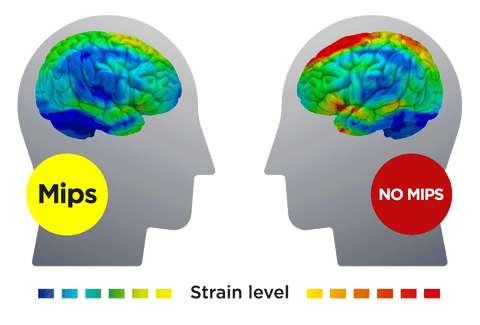 Strain in the brain MIPS
