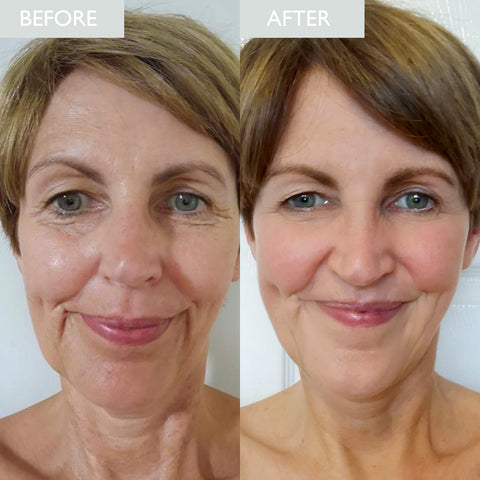 Night cream case study Julie before and after transformation