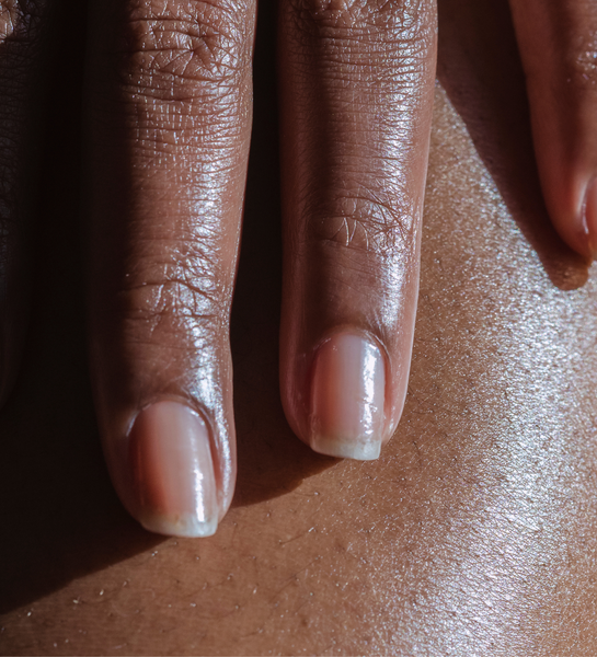 Black woman rubbing skin
