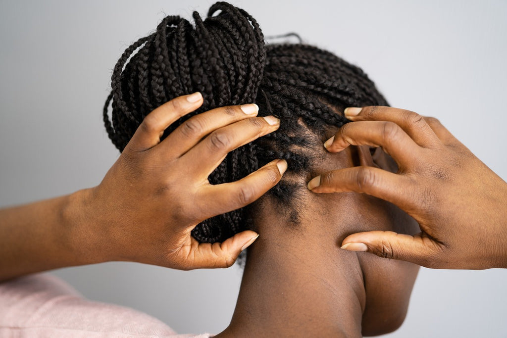 black-woman-with-itchy-scalp