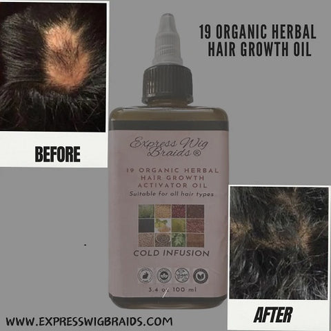 hair growth from using the organic 19 herbal hair growth activator oil for alopecia