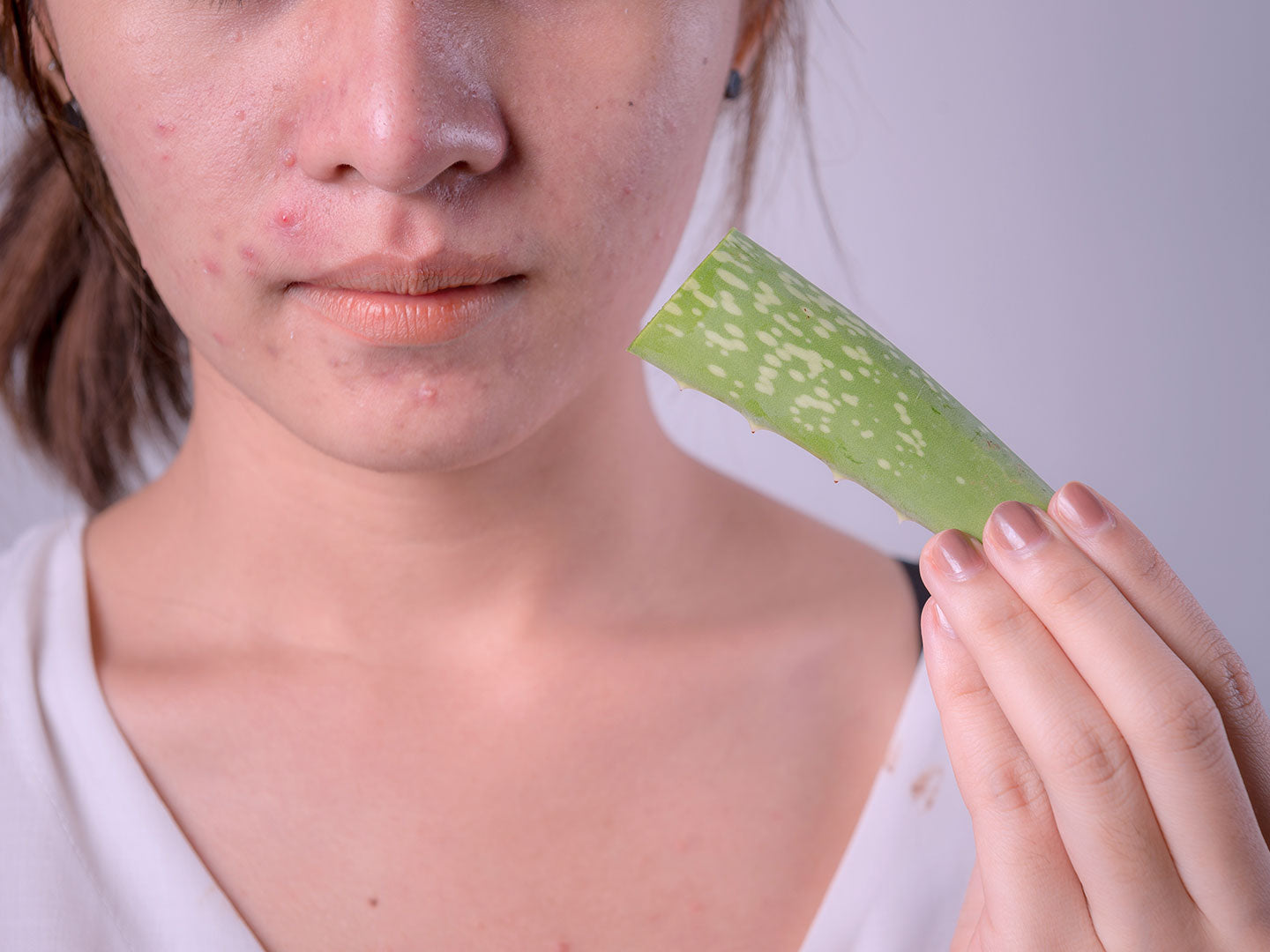 Aloe vera helps to reduce acne