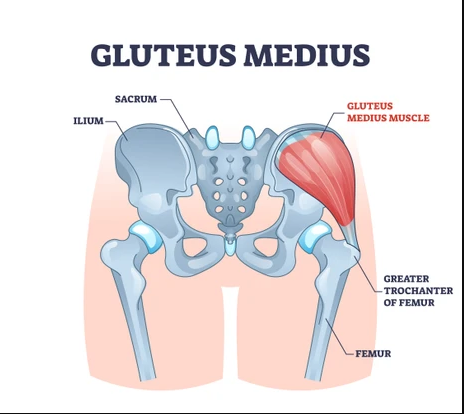 You can strengthen the gluteus medius with exercises such as single-leg lifts
