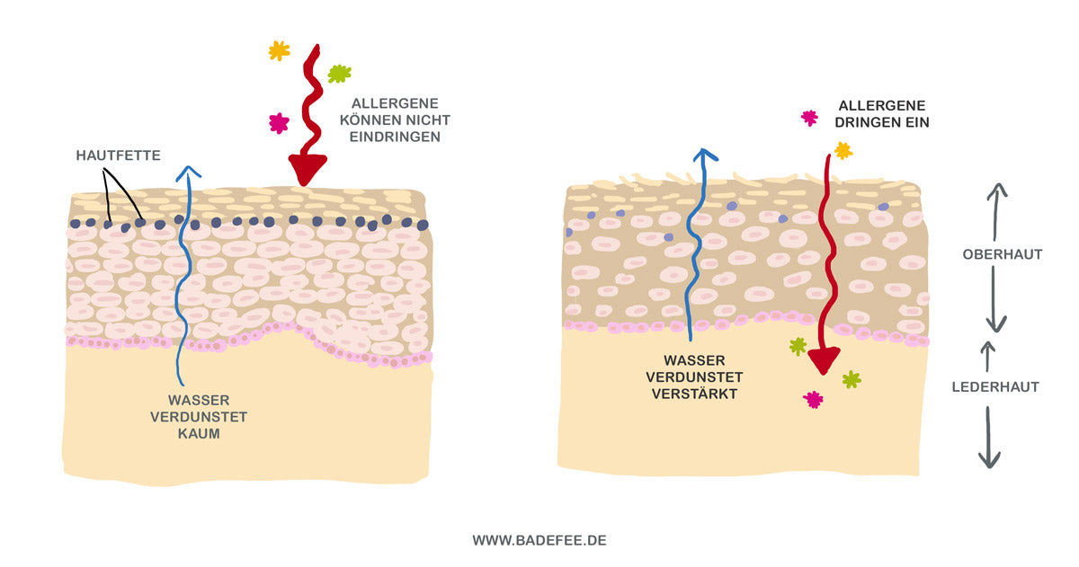 Infografik Hautschicht bei Neurodermitis