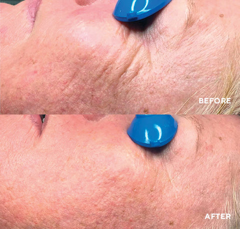 HydroPeptide Nimni Cream Before and After image