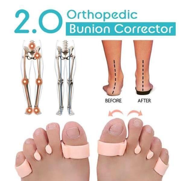2019 Orthopedic Bunion Corrector 2.0 - 1 Pair/Set【BUY 2 ...