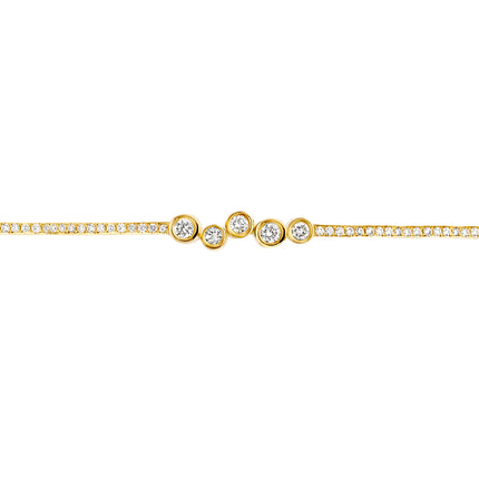Lab Grown Diamond Bracelets with 18K Recycled [colour] Gold | Kimaï
