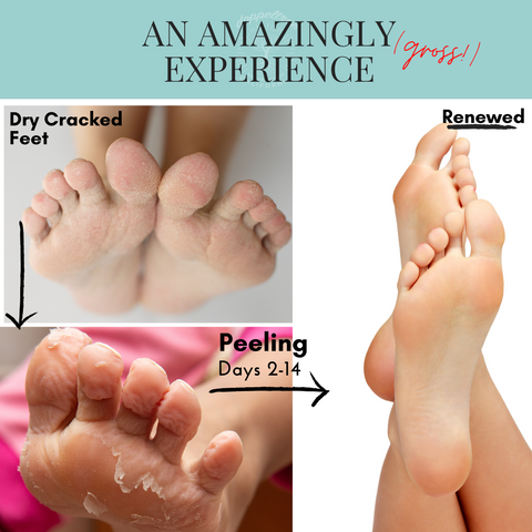 doppeltree foot peel mask an amazingly gross experience