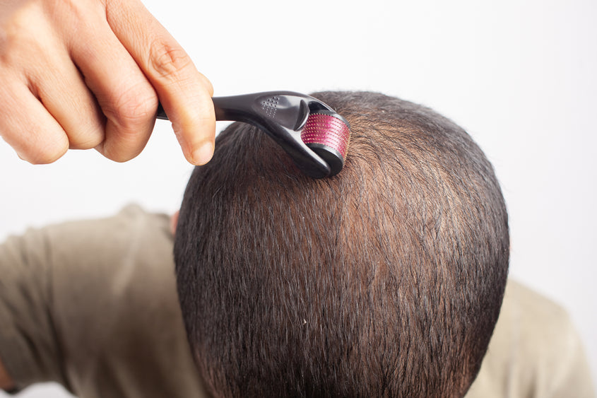 Dermaroller Treatment for Hair Loss All You Need To Know  hairmd