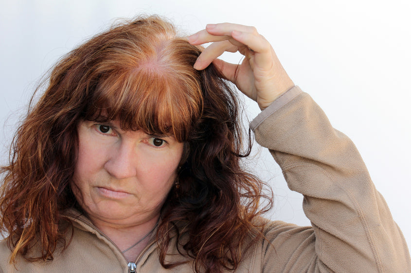 Why Does Hair Loss Occur During Menopause  Genesis Gold