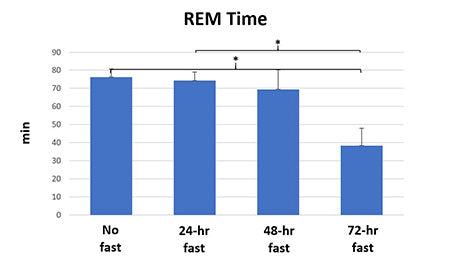 rem-time