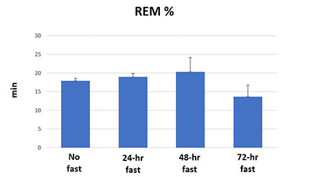 FASTING AND SLEEP: A RETROSPECTIVE ANALYSIS