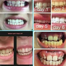BEFORE AND AFTER AP24 ANTIPLACE PASTE