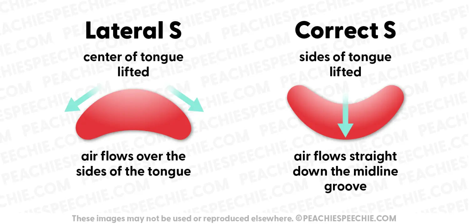 How to Correct a Lateral S