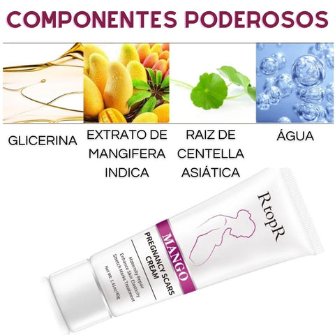 Estrias, tratar estrias, clarear estrias, estrias na gravidez, estrias na gestação, creme para estrias, gravidez, gestação, gestante, grávida, creme anti estrias, tratamento para estrias, creme firmador, creme para grávidas, creme para gestantes