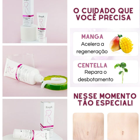 Estrias, tratar estrias, clarear estrias, estrias na gravidez, estrias na gestação, creme para estrias, gravidez, gestação, gestante, grávida, creme anti estrias, tratamento para estrias, creme firmador, creme para grávidas, creme para gestantes