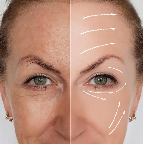 máscara facial, clarear a pele, fototerapia, estética, esteticista, antirrugas, antiacne, antissinais, antiaging, antienvelhecimento, máscara rejuvenescedora, pele perfeita, antimanchas, melasma, skin care, skincare, cuidados com a pele, spa day