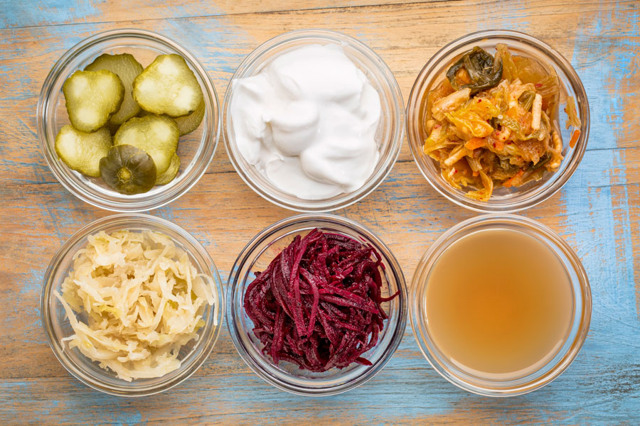 Image of fermented probiotic foods on a table from above