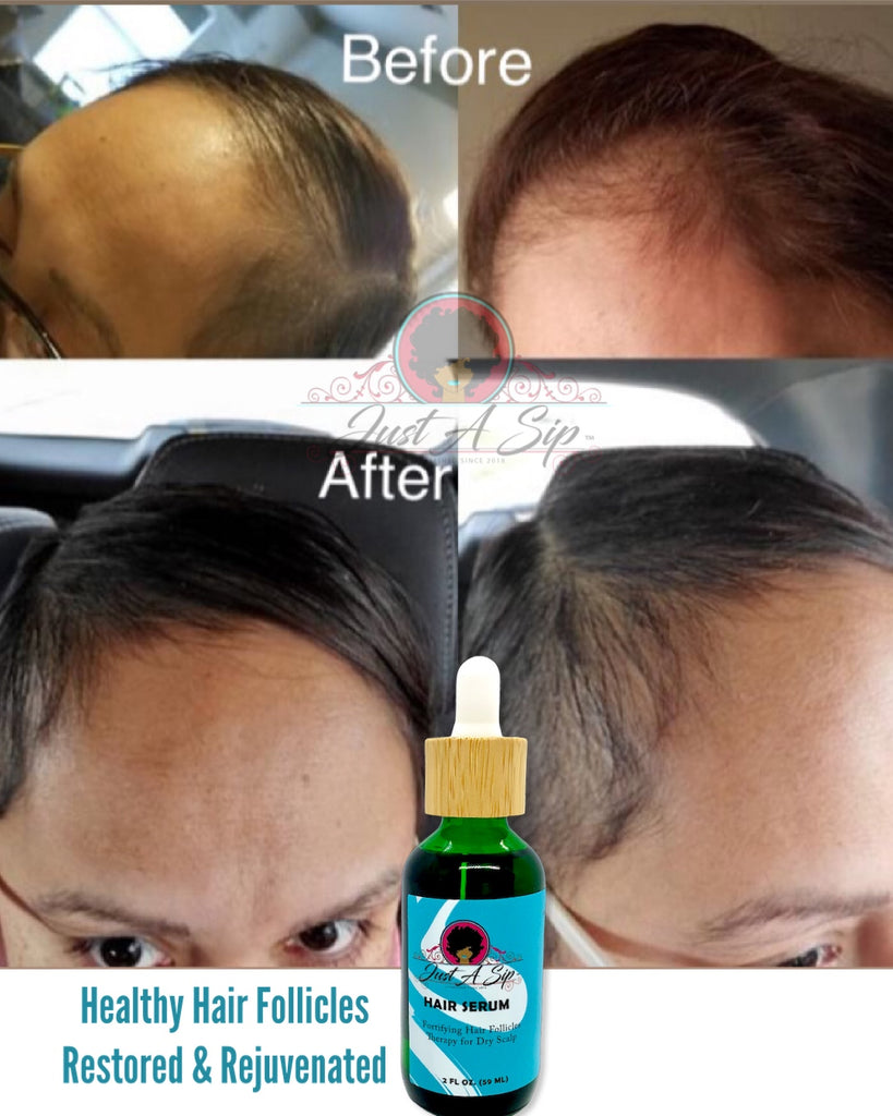 The Best Food To Eat To Prevent Hair Loss  Toppik Malaysia