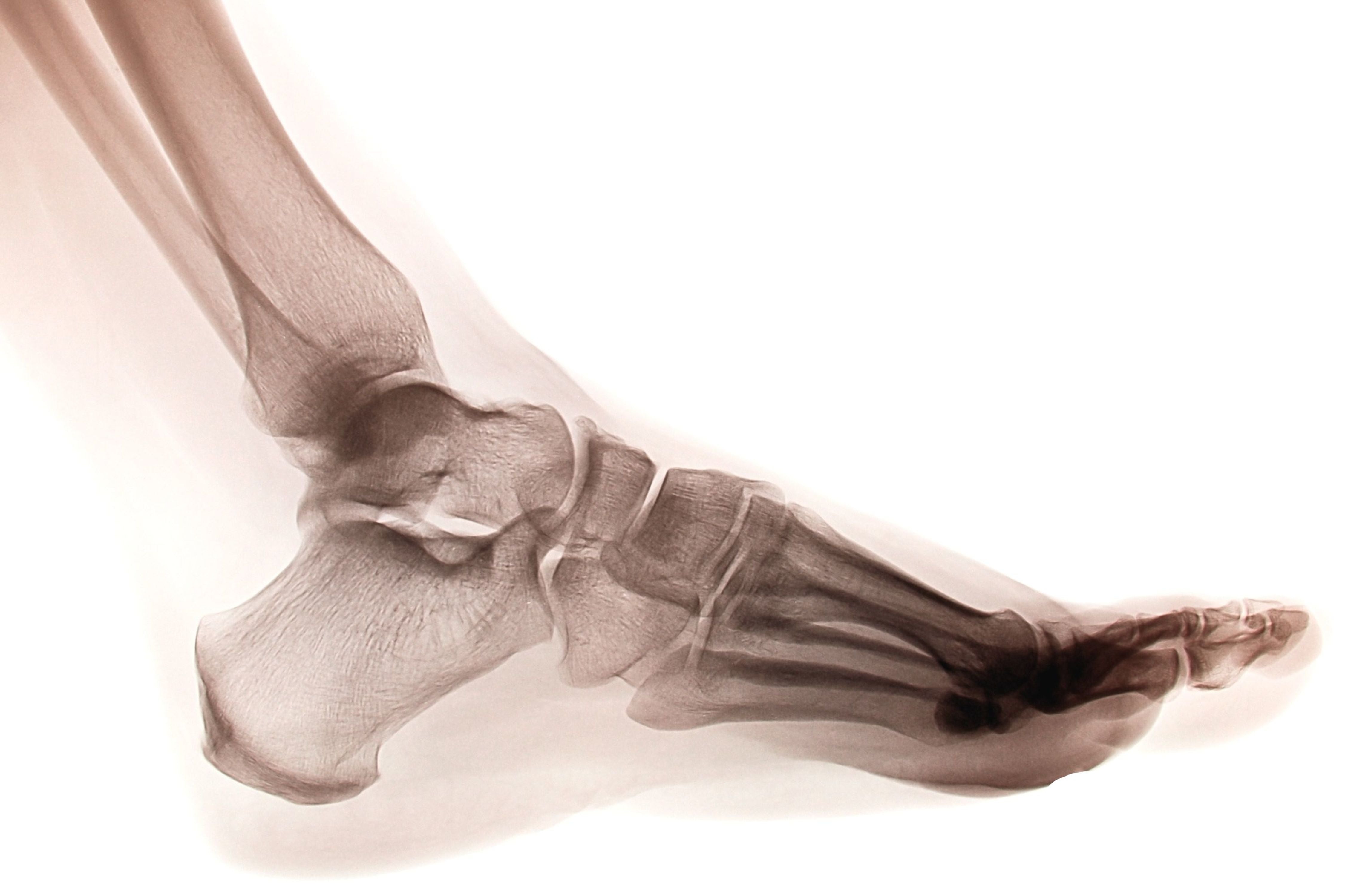 Healing Your Heel Pain After a Long Day 