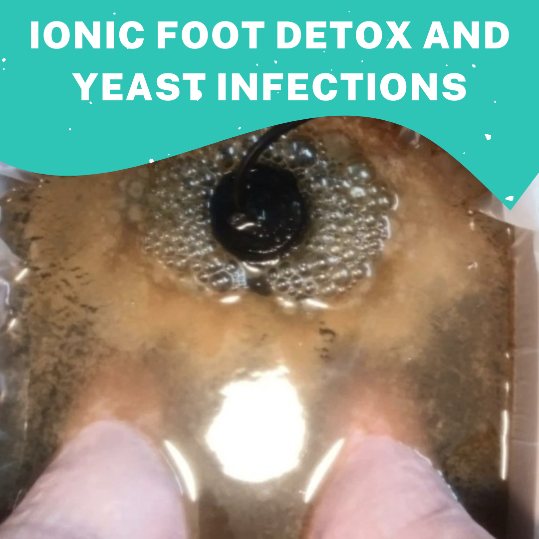 ionic foot detox foot basin after the detox session showing a lot of whitish cheese that suggests there is a lot of yeast in the body