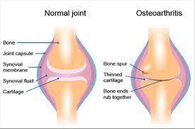 arthritic horse joint compared to normal joint