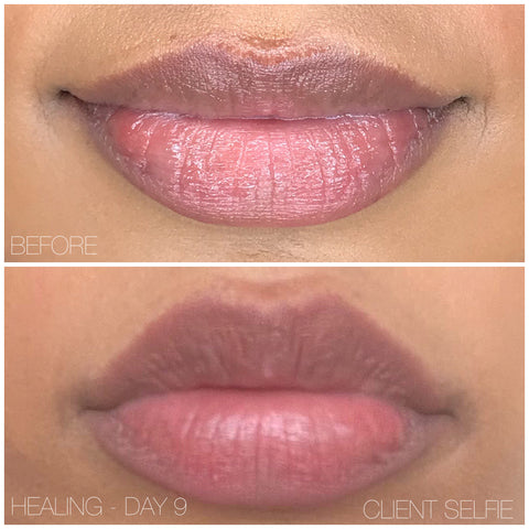 Lip tattoo results from dark lips to a more pinkier tone after Day 9 