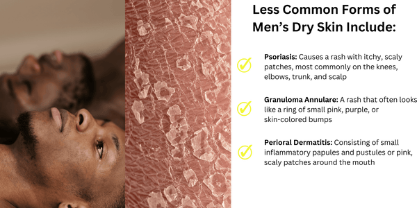Less Common Forms of Men's Dry Skin