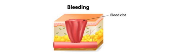 Homeostasis and How Your Skin Heals Itself