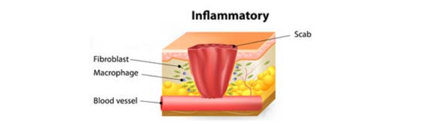 The Inflammatory Phase and How Your Skin Heals Itself