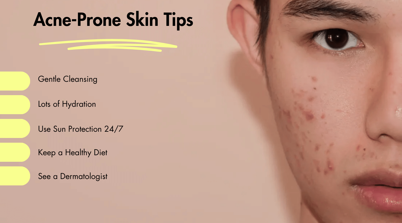 What age is acne the worst? Tips for men with acne-prone skin.