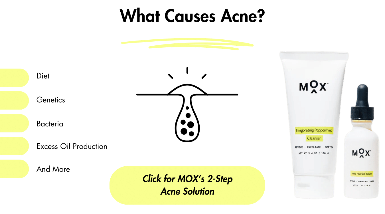 What age is acne the worst? What causes acne?