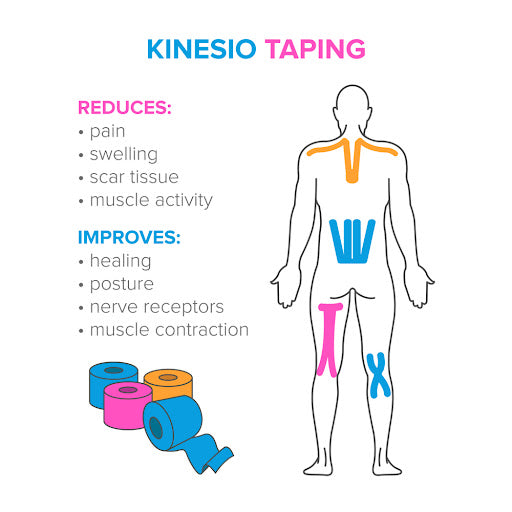 What is Kinesio Tape?