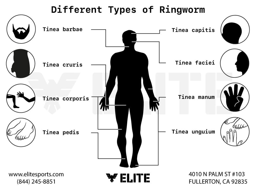 Skin Infection (Ringworm) in Grappling Arts