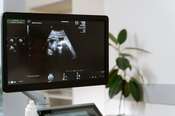 Are Ultrasounds Safe for Babies? What Parents Need to Know